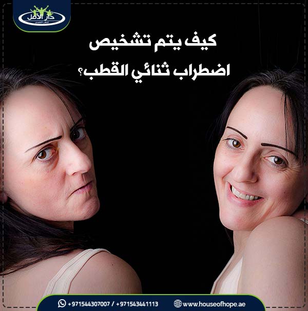 اضطراب ثنائي القطب