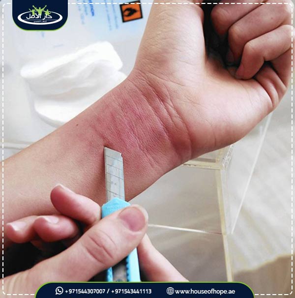 اضطراب الشخصية الحدية 