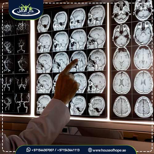 ما لا تعرفه حول الفصام الكتاتوني و3 طرق هامة للعلاج 1 أسباب حدوث الفصام الكتاتوني