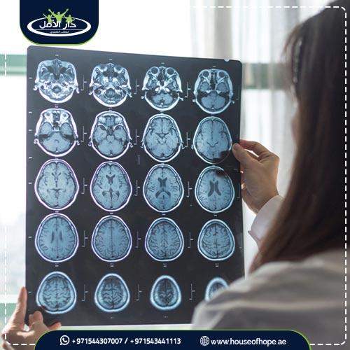 الدليل الكامل حول النوم القهري وأنواعه واهم طرق علاجه تابع معنا 1 أسباب حدوث النوم القهري