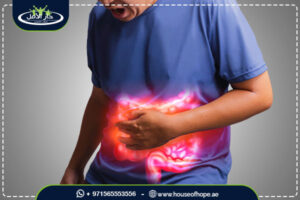 متلازمة القولون العصبي